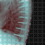 Rods & Screws